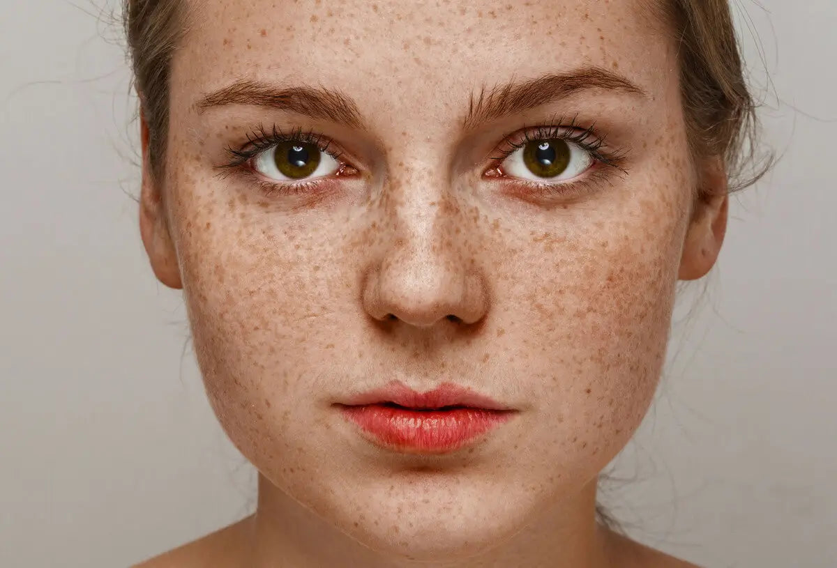 Piegi - skąd się biorą, co oznaczają i jak o nie dbać?