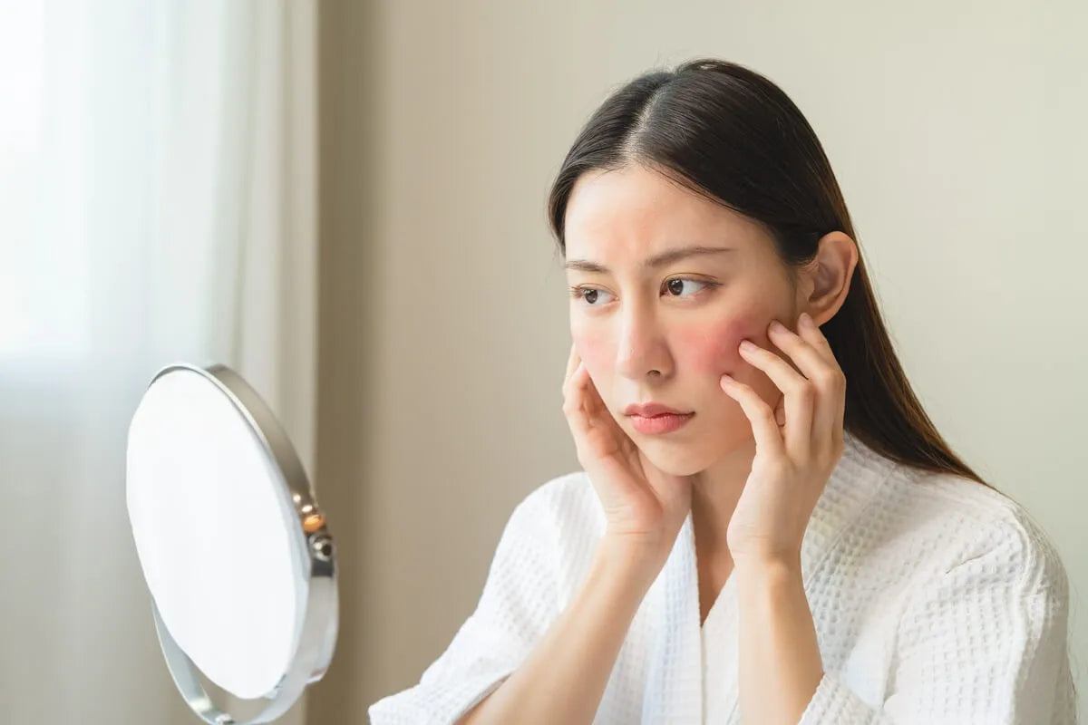 Podrażnienie po retinolu - Jak sobie z nim poradzić?