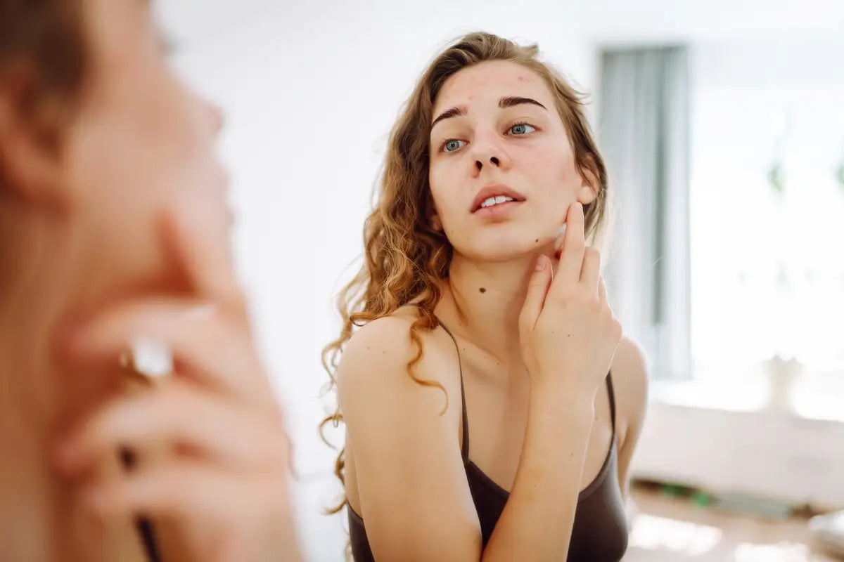 Skóra atopowa: objawy, przyczyny i skuteczna pielęgnacja krok po kroku